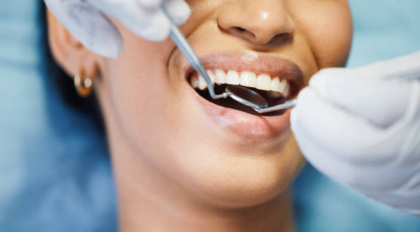 Best Broken or Chipped Tooth Repair in Shenandoah, VA